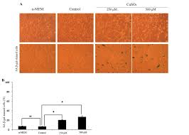 Copper induces cellular senescence in human glioblastoma multiforme cells  through downregulation of Bmi-1