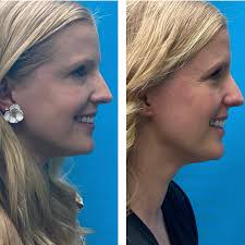 The real blonde mom added a new...