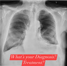 Image result for Succussion Splash