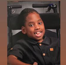 Recovery from Hydrocephalus Surgery