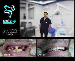 Ahmed elsayed, studied medicine at alazhar university (2018). Center Ahmed Elsayed Ragab Smileup Dentist Vezeeta Com