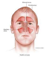Some of the trauma can be as simple as clenching the jaw or grinding teeth. Unlocking The Mystery Of Your Sinuses Mayo Clinic Health System