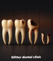 Preventive dental care saves thousands