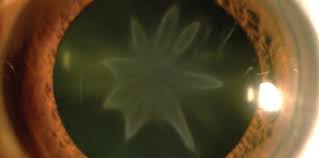 Image result for Pavetta cataractarum