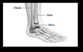Ankle Pain Common Causes And Symptoms Stryker