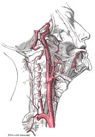 Common arteries in brain | artery is a branch of the innominate artery and the left and right. Carotid Artery Dissection Wikipedia