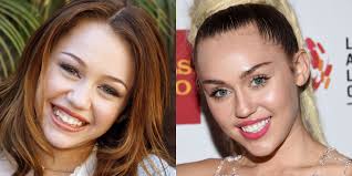 It is wonderful to see them wearing stainless steel braces and not just clear braces and invisalign. Celebrity Smiles Before And Afters Celebrity Dental Work
