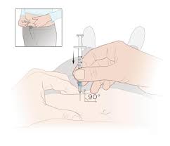 A slight sting is a given with any injection, but there are several other side effects you might have to deal with after a b12 shot. Subcutaneous Injection Definition And Patient Education