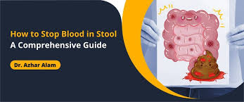 Image result for Blood in stool
