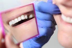 Wann müssen zähne gezogen und durch zahnimplantate ersetzt werden? Zahn Ziehen Schnell Noch Versichern Das Geht Zahnzusatzversicherungen Vergleich