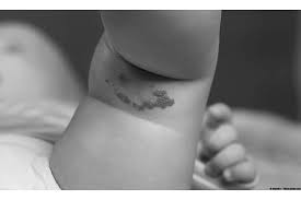 We did not find results for: Birthmarks When Should Parents Be Concerned