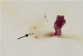 Image result for Rhizobium radiobacter, syn. Agrobacterium tumefaciens