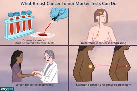 breast cancer tumor marker tests