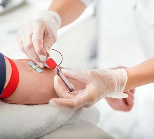 Vitamin Test product image