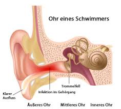 Ohrenschmerzen Ursachen Behandlung Vorbeugung