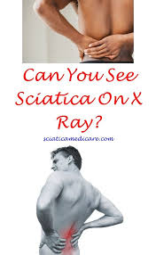 Pin On Sciatica