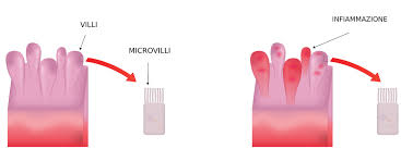 Alcuni alimenti sono particolarmente indicati, poiché in grado di ridurre l'infiammazione e ripristinare la flora batterica intestinale. Colite Cosa Mangiare E Cosa No Ecco La Mini Guida Blog Dr Giorgini