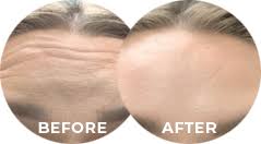 Skin perfect medical aesthetics is located in walnut, california. Top Medical Spa Los Angeles Orange County Skin Perfect Medical