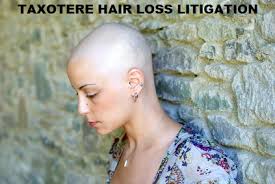ohio hair loss lawyer Archives