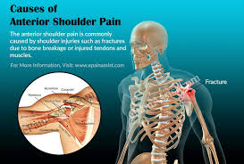 All of them are supplied by the respective branches of the brachial plexus. What Is Anterior Shoulder Pain Causes Symptoms Treatment Exercise Diagnosis