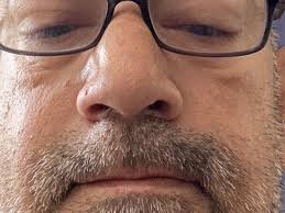 Fundraiser by Edwin Mojica : Support Edwin Mojica's Fight Against Kidney  Failure