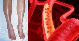 Forme primarie (circa 80% del totale) e forme secondarie(20%). H 4aw4jkantuqm