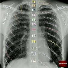 Pin By Natalia Casis On Xray Radiology Student Medical School Studying Medical Knowledge