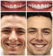 Meet Dr Tyler Broadbent