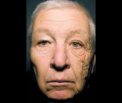 Reminder to take care of your skin outdoors