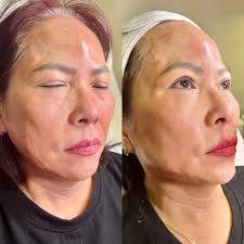 PUR LIFE Medical Steiner Ranch Austin