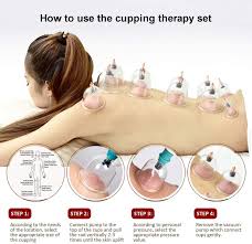 Only three sessions, a month or more apart, can be done in a year. Amazon Com Cupping Therapy Sets Hijama Cupping Vacuum Suction 24 Cups Sets For Cellulite Cupping Massage Back Pain Relief Chinese Cupping Therapy Pump Hijama Health Personal Care