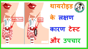 thyroid test t3 t4 and tsh explained in hindi