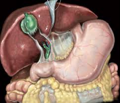 Les analyses de sang présentent deux types de résultats : Vesicule Biliaire Valence Centre De Chirurgie Viscerale Drome Ardeche