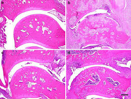 Prevention Of Progressive Joint Destruction In Collagen Induced Arthritis In Rats By A Novel Matrix Metalloproteinase Inhibitor Fr255031 Ishikawa 2005 British Journal Of Pharmacology Wiley Online Library