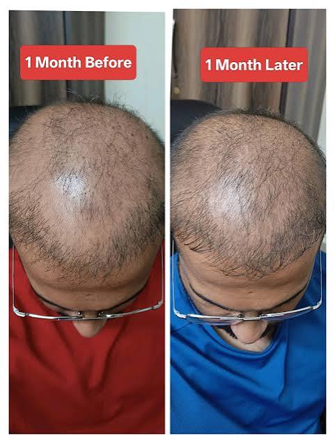 Cabello cuidado con VELORA