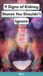 Kidney Stones Have No Easy Remedy Everything From Your Hydration Levels And Diet Can Cause Differe In 2020 Signs Of Kidney Stones Kidney Stones Kidney Stones Symptoms