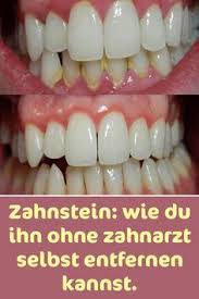Zahnstein Wie Du Ihn Ohne Zahnarzt Selbst Entfernen Kannst Zahnarzt Zahnstein Zahne
