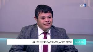 في هذه الأمراض في النمط النووي المريض لديه سبعة وأربعين الكروموسومات بسبب التثلث الصبغي في الحادي والعشرين الزوج. ÙÙŠ Ø¹ÙŠØ¯ Ø§Ù„Ø£Ù… ØªØ¹Ø±Ù Ø¹Ù„Ù‰ Ù‚ØµØ© Ø³ÙŠØ¯Ø© Ø¹Ø¸ÙŠÙ…Ø© Ø®Ù„Ù Ø¨Ø·Ù„ Ù…ØªÙ„Ø§Ø²Ù…Ø© Ø¯Ø§ÙˆÙ† Youtube
