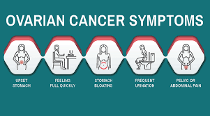 Ovarian cancer signs & symptoms can be hard to detect, but may include abdominal bloating or swelling. All About Ovarian Cancer Facts