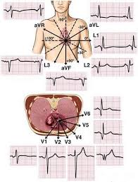 Reading Ecg Interpretation Of Ekgs Is A Daily Activity For Cardiology Physician Cardiology Physician Assistant Specialties Ecg Interpretation