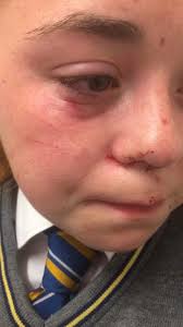 My daughter is 'terrified' to get