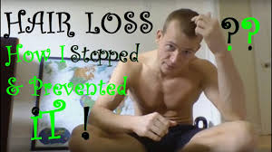 The Eternal Male Pattern Baldness Mistery Solved Page 3 Hairlosstalk Forums