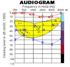 For this reason, it is important to review the notes section of the audiogram to see how your. 15 Audiograms Ideas Audiology Audiology Student Hearing Loss
