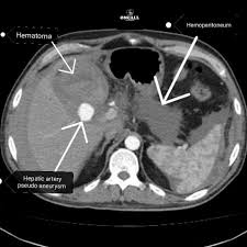 Pin On Abdomen Pelvis