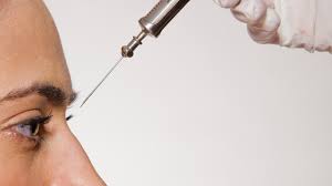 فیلر چیست و چ کاربردی دارد؟