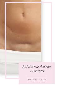 Reduire Une Cicatrice Au Naturel Cicatrice Acne Naturelle