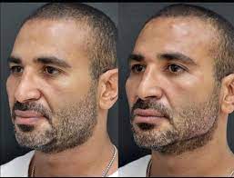 We did not find results for: ØµÙˆØ± Ø¨Ø¹Ø¯ Ø¬Ø¯Ù„ ØªØ§Ù…Ø± Ø­Ø³Ù†ÙŠ ÙˆØ£Ø­Ù…Ø¯ Ø³Ø¹Ø¯ Ø¹Ù…Ù„ÙŠØ§Øª Ø§Ù„ØªØ¬Ù…ÙŠÙ„ ØªØ¬Ø°Ø¨ Ø§Ù„Ù†Ø¬ÙˆÙ… Ù…ØµØ± Ø§Ù„Ø¹Ø±Ø¨ÙŠØ©