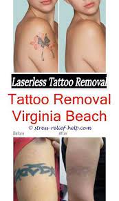 Average Cost Of Tattoo Removal Over The Counter Tattoo Removal Plastic Surgery Tattoo Removal Cost Laser Tattoo Removal Tattoo Removal
