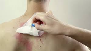 Actually, the liquid bandage is a relevant skin healing for eruptions, scuffs and small cuts. Removing Big Bandage Uncover Red Stock Footage Video 100 Royalty Free 12696599 Shutterstock