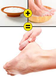 In the morning, wash off with lukewarm water. 10 Home Remedies To Remove Cracked Heels And Get Beautiful Feet